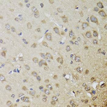 Anti-CHN1 Antibody Anti-CHN1 Antibody