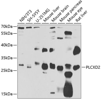 Anti-PLCXD2 Antibody