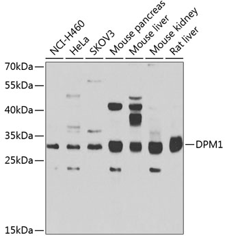 Anti-DPM1 Antibody