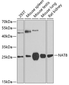 Anti-NAT8 Antibody