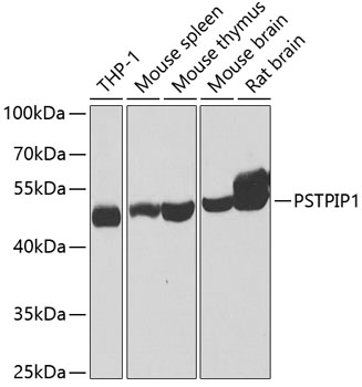 Anti-PSTPIP1 Antibody