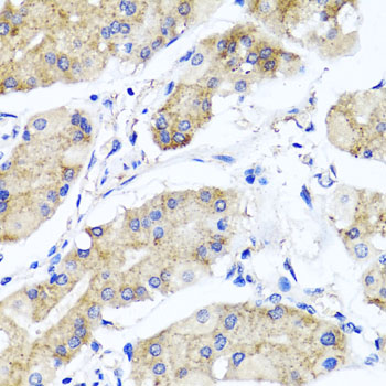 Anti-PSTPIP1 Antibody Anti-PSTPIP1 Antibody