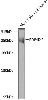 Anti-PDE4DIP Antibody