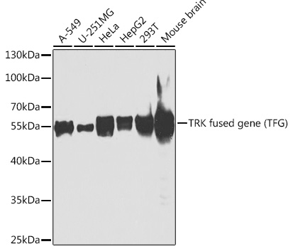 Anti-TRK fused gene Antibody