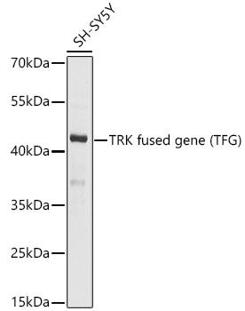 Anti-TRK fused gene Antibody Anti-TRK fused gene Antibody