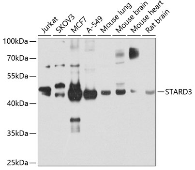 Anti-MLN64 Antibody