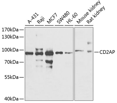 Anti-CD2AP Antibody