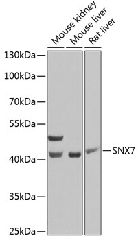 Anti-SNX7 Antibody