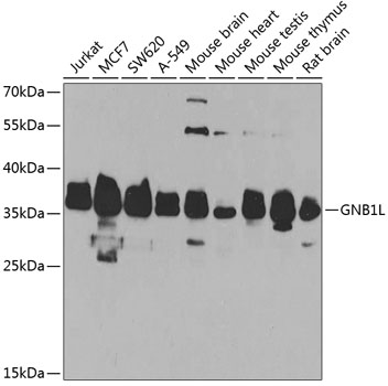 Anti-GNB1L Antibody