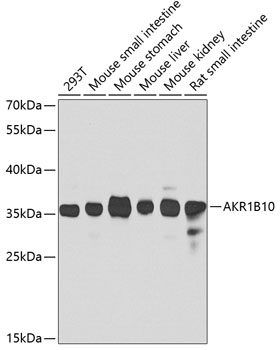 Anti-AKR1B10 Antibody