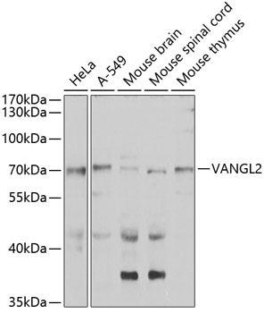 Anti-VANGL2 Antibody