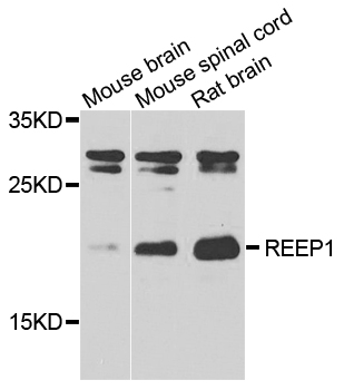 Anti-REEP1 Antibody