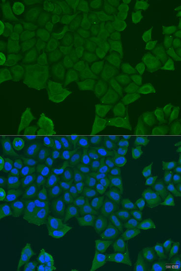 Anti-REEP1 Antibody Anti-REEP1 Antibody