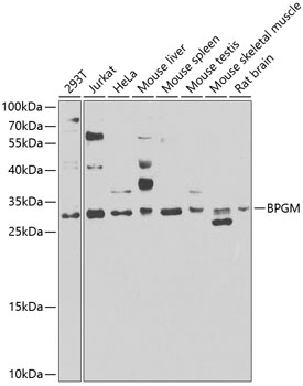Anti-BPGM Antibody