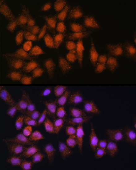 Anti-BPGM Antibody Anti-BPGM Antibody