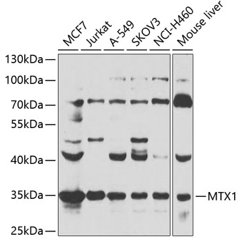 Anti-MTX1 Antibody