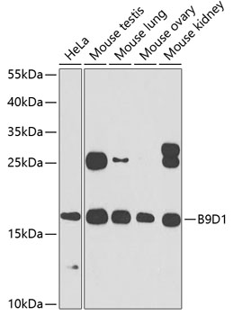 Anti-B9D1 Antibody