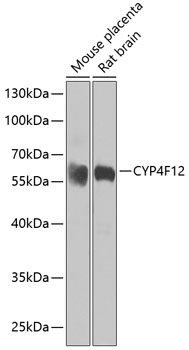 Anti-CYP4F12 Antibody