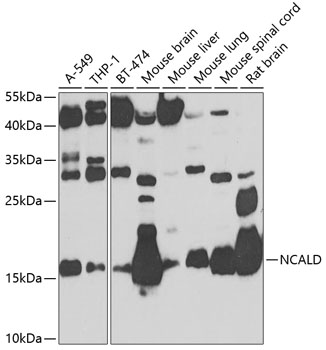 Anti-NCALD Antibody