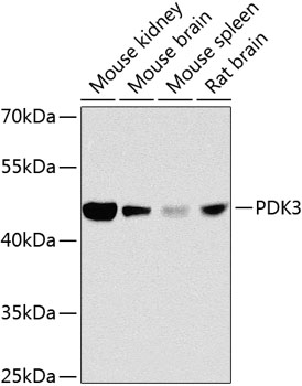 Anti-PDK3 Antibody