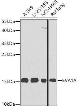 Anti-EVA1A Antibody