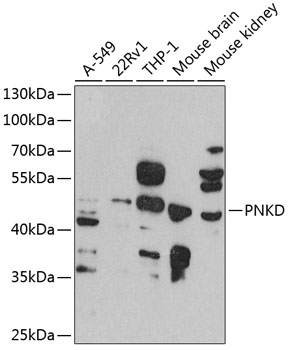 Anti-PNKD Antibody