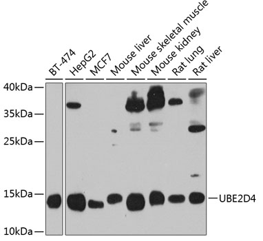 Anti-UBE2D4 Antibody