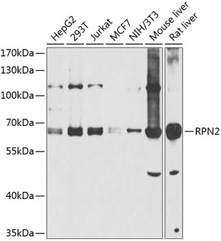 Anti-RPN2 Antibody