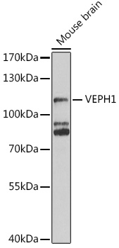 Anti-VEPH1 Antibody Anti-VEPH1 Antibody