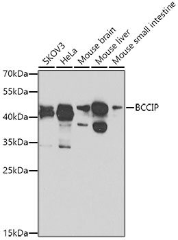 Anti-BCCIP Antibody