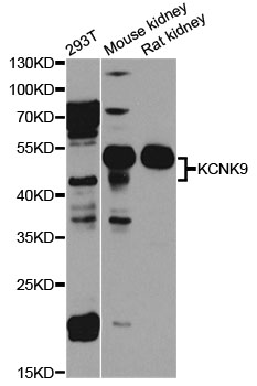 Anti-KCNK9 Antibody