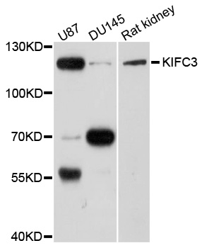 Anti-KIFC3 Antibody