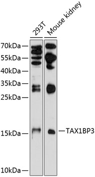 Anti-TIP-1 Antibody