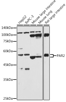 Anti-PAR2 Antibody