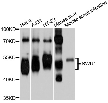 Anti-SMU1 Antibody