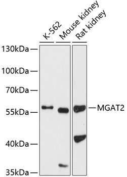 Anti-MGAT2 Antibody