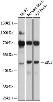 Anti-ZIC3 Antibody