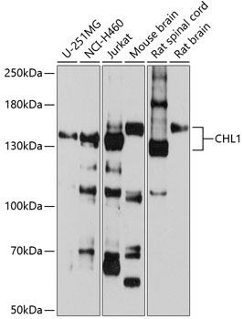 Anti-CHL1 Antibody
