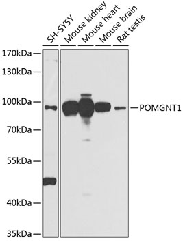 Anti-POMGNT1 Antibody