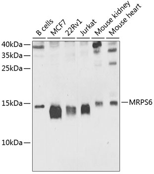 Anti-MRPS6 Antibody