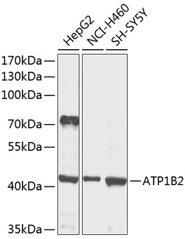 Anti-ATP1B2 Antibody