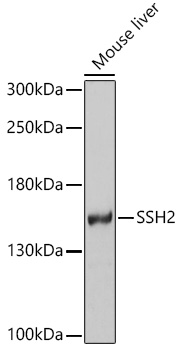 Anti-SSH2 Antibody