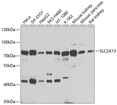 Anti-SLC2A13 Antibody