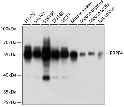 Anti-PRPF4 Antibody