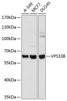 Anti-VPS33B Antibody