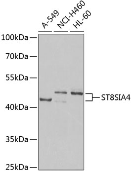 Anti-ST8SIA4 Antibody