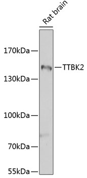 Anti-TTBK2 Antibody