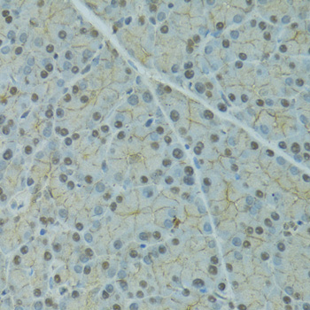 Anti-SERPINF2 Antibody Anti-SERPINF2 Antibody