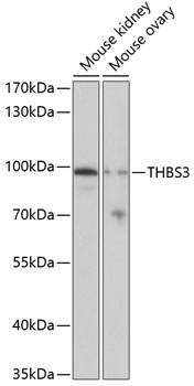 Anti-THBS3 Antibody