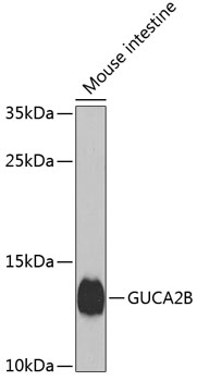 Anti-Uroguanylin Antibody